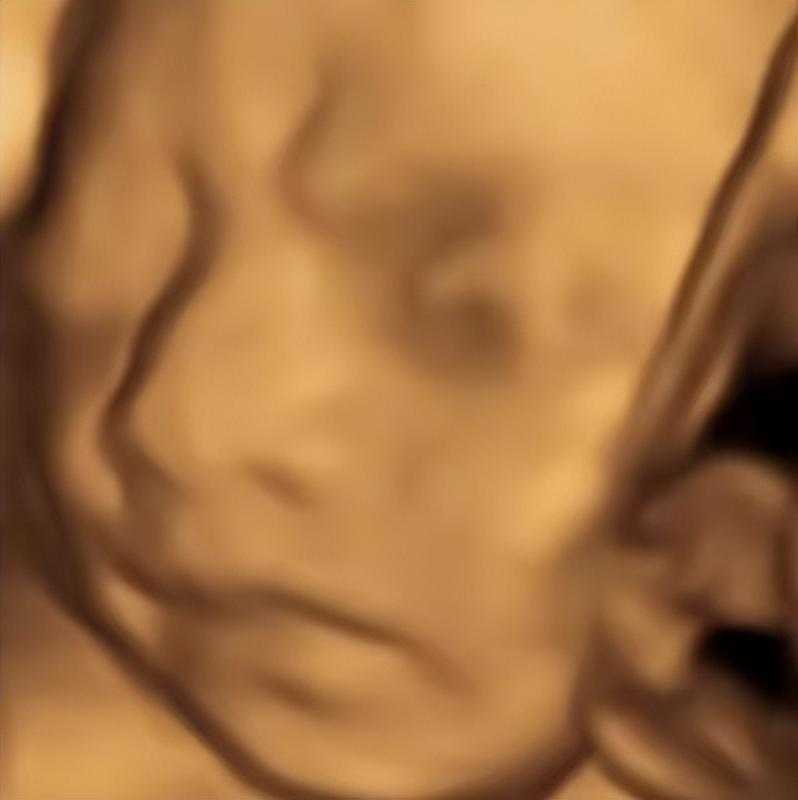 AI四维彩超预测，一单9.9-98，3分钟出图，一天变现1000+【揭秘】